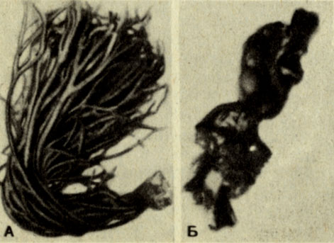 Рис. 8-9. Морские зеленые водоросли (тип Chlоrophyta): A. Codium. Б. Ulva (морской салат) (Фото R.D.Allen.)