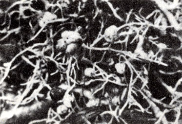 Рис. 10-2. Клубеньки, содержащие Rhizobium, на корнях шелковой акации Albizzia. (Фото R. Speck.)